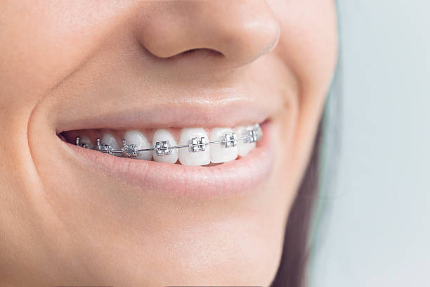 Best Traditional Braces  in Esparto, CA